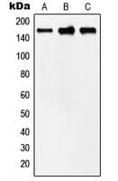 Polyclonal Rabbit anti-Human MYOM2 / Myomesin 2 Antibody (Internal, WB)