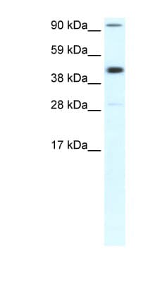 Polyclonal Rabbit anti-Human POLR2B / RPB2 Antibody (aa805-854, IHC, WB)