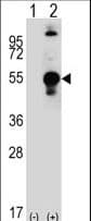 LECT1 / Chondromodulin-I Antibody (aa253-281)