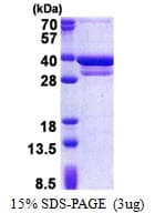Human CUEDC2 Protein (Recombinant His)