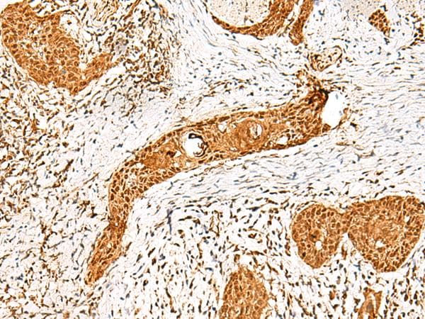 PPOX Antibody