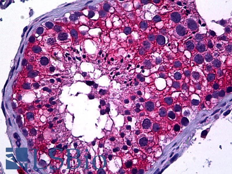 IHC-plus™ DIAPH2 Antibody (aa56-114)