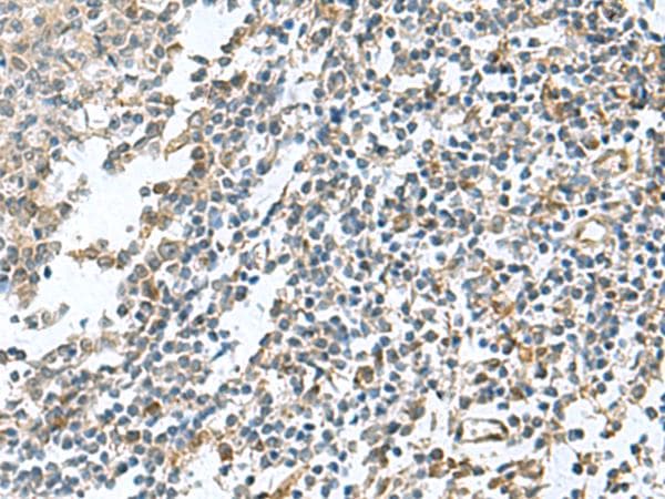 PAPSS2 Antibody