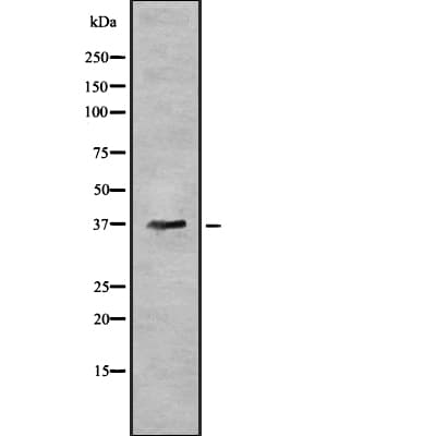 AWAT1 / DGAT2L3 Antibody
