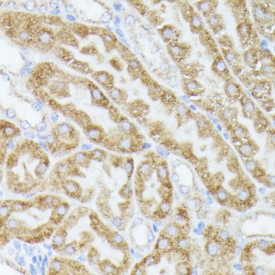 Polyclonal Rabbit anti-Human ACAT2 Antibody (IHC, IF)