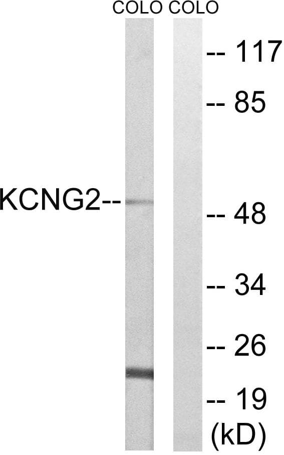 KCNG2 Antibody