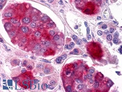 PathPlus™ GALR1 / Galanin Receptor 1 Antibody (Extracellular Domain)