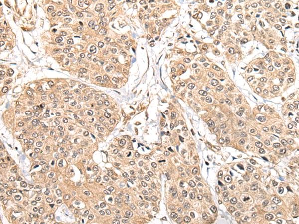 Polyclonal Rabbit anti-Human ATL3 Antibody (IHC, WB)