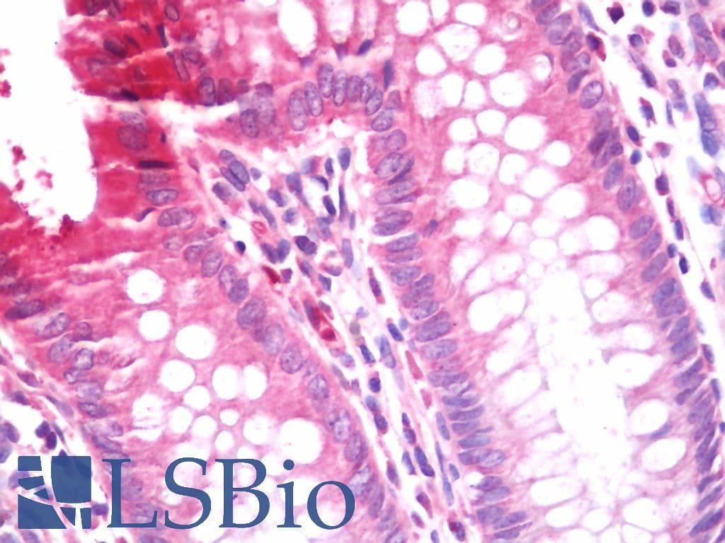 IHC-plus™ PP2CB / PPP2CB Antibody