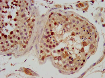 RFX2 Antibody