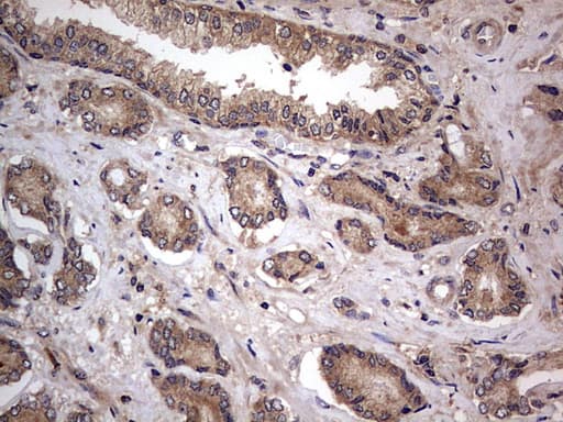 Monoclonal Mouse anti-Human ARAF / ARAF1 / A-RAF Antibody (clone OTI2G9, aa145-365, IHC, WB)