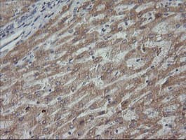 MAP2K3 / MEK3 / MKK3 Antibody (clone OTI5C7, Carrier-free)