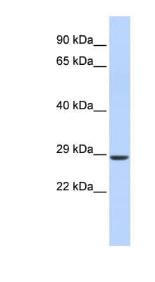SIX2 Antibody (aa35-84)