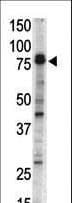 DCLK / DCLK1 Antibody (aa1-30)