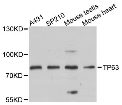 TP63 / p63 Antibody