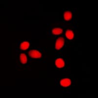 Polyclonal Rabbit anti-Human LMNA / Lamin A+C Antibody (phospho-Ser392, IHC, IF, WB)