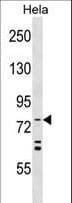 Apg7 / ATG7 Antibody (aa494-523)
