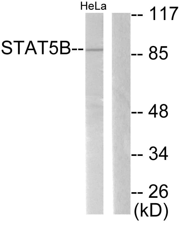 Polyclonal Rabbit anti-Human STAT5B Antibody (aa697-746, IHC, WB)