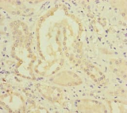 MMACHC Antibody