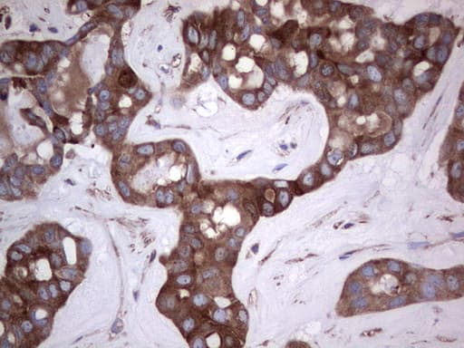 GARS / Glycyl tRNA Synthetase Antibody (clone OTI4G4)