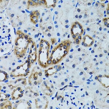 RPN1 / Ribophorin I Antibody