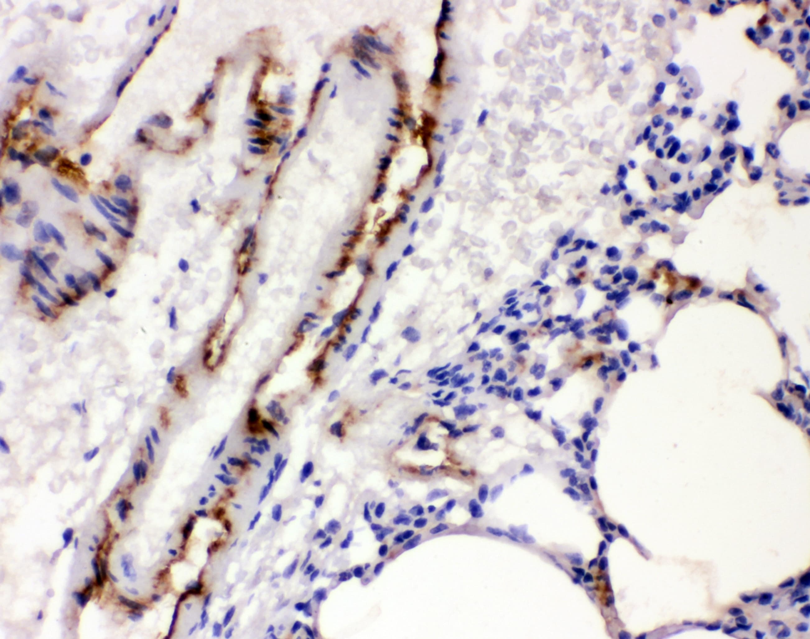VWF / Von Willebrand Factor Antibody (aa1304-1452)