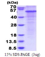 Human Properdin / CFP Protein (Recombinant His)
