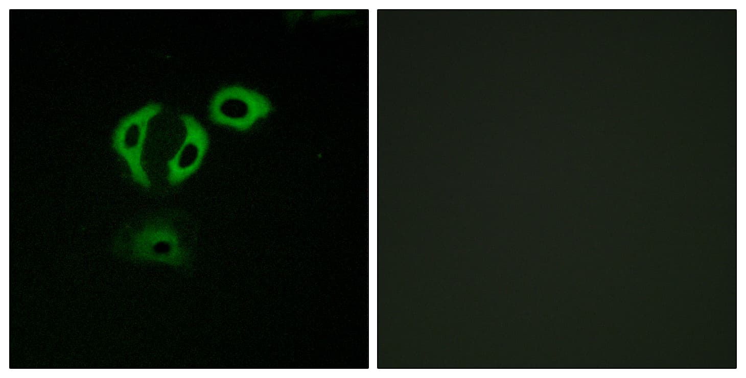 ERIC-1 / TACC3 Antibody (aa789-838)
