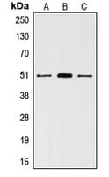 Polyclonal Rabbit anti-Human Vitamin D Receptor / VDR Antibody (aa196-235, IHC, IF, WB)