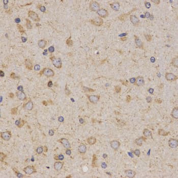 Polyclonal Rabbit anti-Human EIF2AK2 / PKR Antibody (IHC, WB)