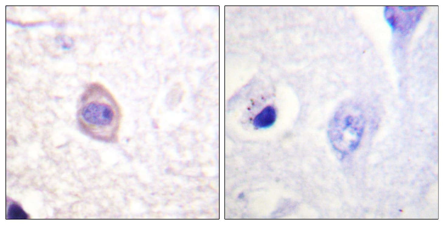 CD119 / IFNGR1 Antibody (phospho-Tyr457)