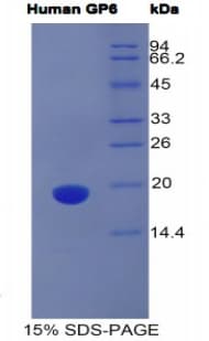 Human GP6 / GPVI Protein (Recombinant His)