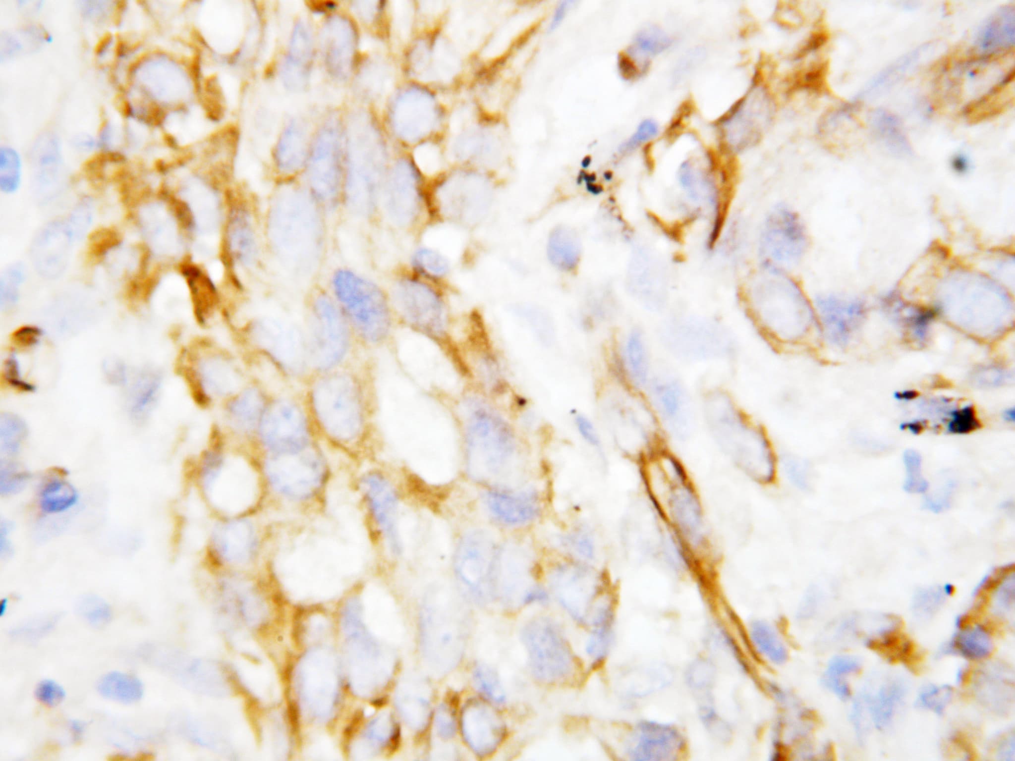 Polyclonal Rabbit anti-Human DEFB1 / BD-1 Antibody (aa52-68, IHC, WB)