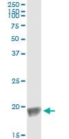 BIRC5 / Survivin Antibody (clone 5B10)