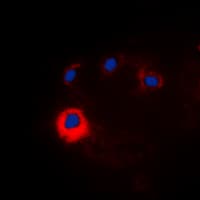Polyclonal Rabbit anti-Human NOTCH1 Antibody (Internal, IHC, IF, WB)