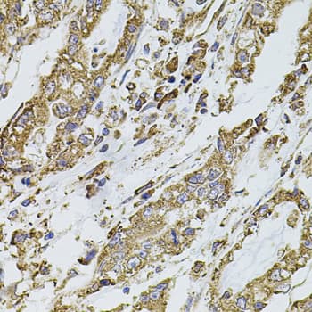 PIK3CA / PI3K Alpha Antibody