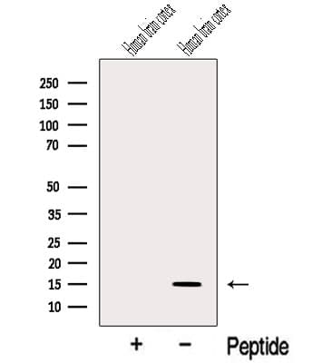 Polyclonal Rabbit anti-Human NRN1 / Neuritin Antibody (WB)