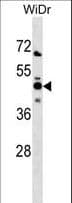Polyclonal Rabbit anti-Human NMI Antibody (aa1-30, WB)