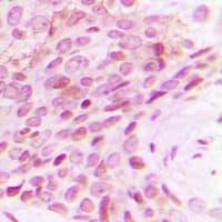 Polyclonal Rabbit anti-Human POLR2E Antibody (Internal, IHC, WB)