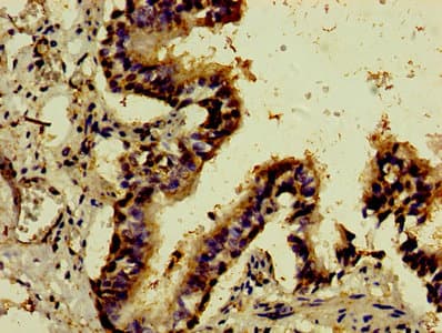 ATF3 Antibody