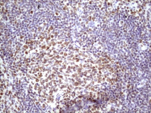 IKBKE / IKKI / IKKE Antibody (aa474-716, clone OTI3C5)