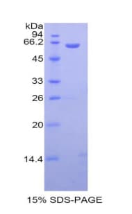 Rat CD95 / FAS Protein (Recombinant His-MBP)