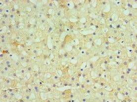 HSD11B1 / HSD11B Antibody (aa25-292)