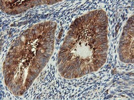 PFKP Antibody (clone OTI3G8, Carrier-free)