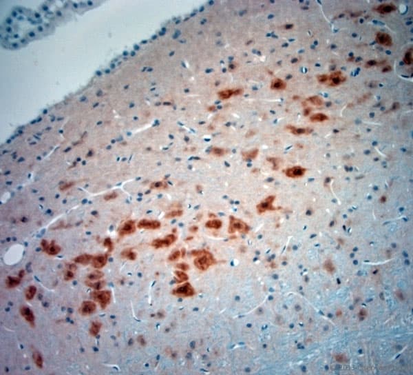 Polyclonal Rabbit anti-Human NeuN Antibody (aa80-130, IHC, WB)