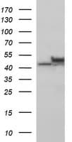 TUBB2B / Tubulin Beta 2B Antibody (clone OTI2G1, Carrier-free)