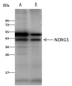 NDRG1 Antibody (Preservative Free)