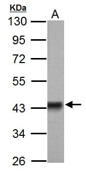 IHC-plus™ PDHA1 / PDH E1 Alpha Antibody (aa39-325)