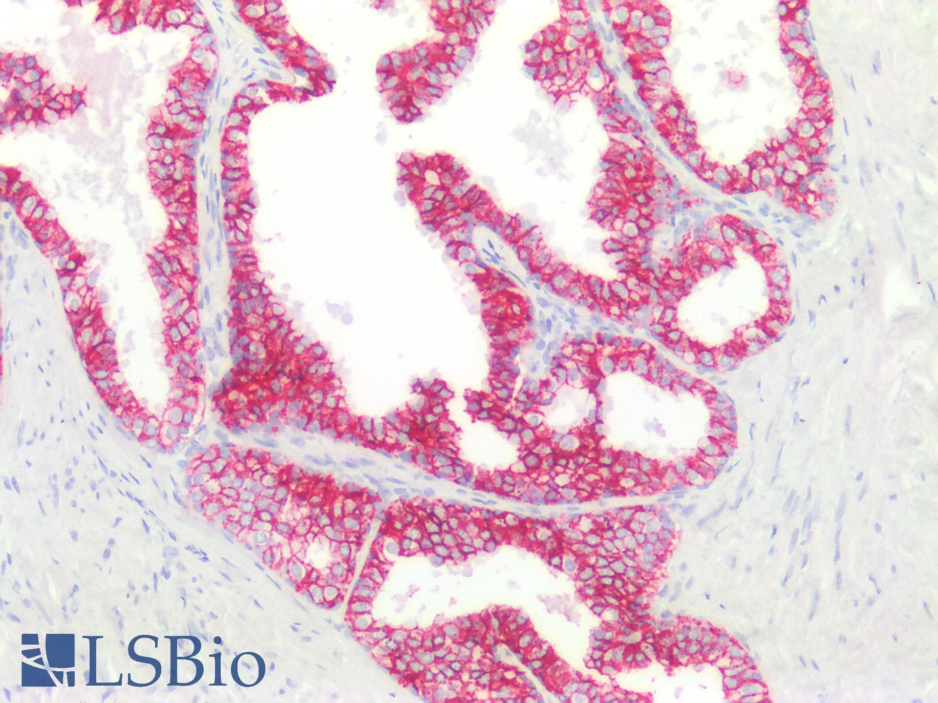 PathPlus™ CLDN4 / Claudin 4 Antibody (aa160-209)