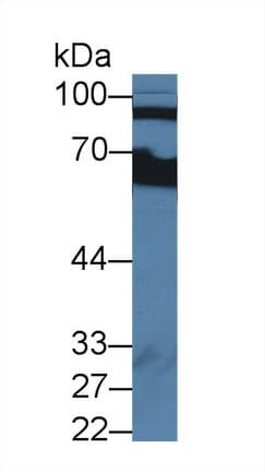 CFB / Complement Factor B Antibody (aa35-160)
